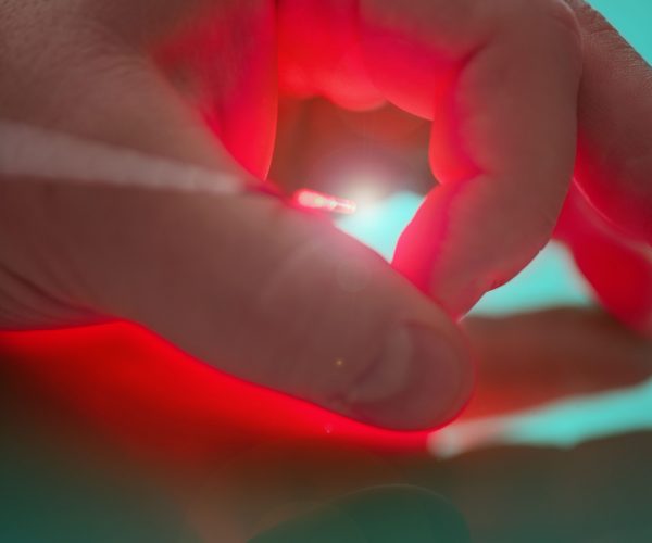Source of bright light on the end of the probe for treatment by means of the laser between big and forefingers of the left hand of the person with reflection.