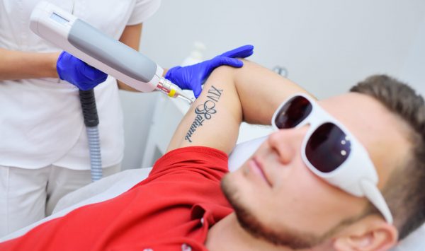 The Cosmetologist removes the patient’s tattoo with a neodymium laser. The Cosmetologist removes the patient's tattoo with a neodymium laser. Laser cosmetology